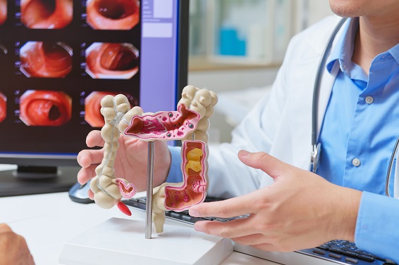 Has your doctor recommended a colonoscopy or gastroscopy? | Procedure Overview, Preparation Tips and Cost Guide